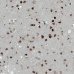 MEF2C Antibody in Immunohistochemistry (Paraffin) (IHC (P))