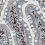 MEF2C Antibody in Immunohistochemistry (Paraffin) (IHC (P))