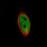 MEF2C Antibody in Immunocytochemistry (ICC/IF)