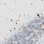 MEF2C Antibody in Immunohistochemistry (Paraffin) (IHC (P))