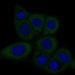 Dicer Antibody in Immunocytochemistry (ICC/IF)