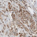 Dicer Antibody in Immunohistochemistry (Paraffin) (IHC (P))