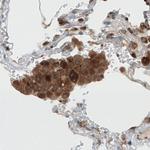 Dicer Antibody in Immunohistochemistry (Paraffin) (IHC (P))