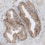 Dicer Antibody in Immunohistochemistry (Paraffin) (IHC (P))