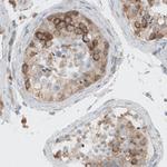 Dicer Antibody in Immunohistochemistry (Paraffin) (IHC (P))