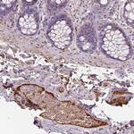 Apolipoprotein A4 Antibody in Immunohistochemistry (Paraffin) (IHC (P))