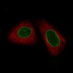 ERCC1 Antibody in Immunocytochemistry (ICC/IF)