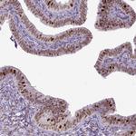 ERCC1 Antibody in Immunohistochemistry (Paraffin) (IHC (P))