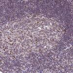 ERCC1 Antibody in Immunohistochemistry (Paraffin) (IHC (P))