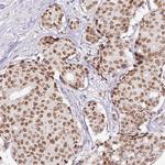 ERCC1 Antibody in Immunohistochemistry (Paraffin) (IHC (P))