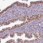 ERCC1 Antibody in Immunohistochemistry (Paraffin) (IHC (P))