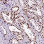 ERCC1 Antibody in Immunohistochemistry (Paraffin) (IHC (P))