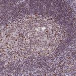 ERCC1 Antibody in Immunohistochemistry (Paraffin) (IHC (P))