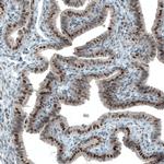 ATF3 Antibody in Immunohistochemistry (Paraffin) (IHC (P))