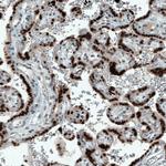 ATF3 Antibody in Immunohistochemistry (Paraffin) (IHC (P))