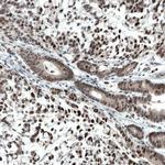 ATF3 Antibody in Immunohistochemistry (Paraffin) (IHC (P))