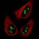 NIFK Antibody in Immunocytochemistry (ICC/IF)