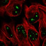 NIFK Antibody in Immunocytochemistry (ICC/IF)