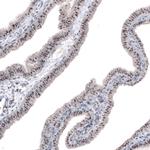 NIFK Antibody in Immunohistochemistry (Paraffin) (IHC (P))