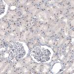 NIFK Antibody in Immunohistochemistry (Paraffin) (IHC (P))