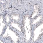 NIFK Antibody in Immunohistochemistry (Paraffin) (IHC (P))