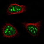 NIFK Antibody in Immunocytochemistry (ICC/IF)