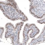 NIFK Antibody in Immunohistochemistry (Paraffin) (IHC (P))