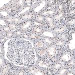 NIFK Antibody in Immunohistochemistry (Paraffin) (IHC (P))