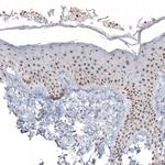 NIFK Antibody in Immunohistochemistry (Paraffin) (IHC (P))