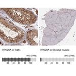 VPS26A Antibody