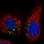 VPS26A Antibody in Immunocytochemistry (ICC/IF)