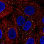 VPS26A Antibody in Immunocytochemistry (ICC/IF)