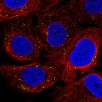 VPS26A Antibody in Immunocytochemistry (ICC/IF)