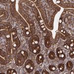 VPS26A Antibody in Immunohistochemistry (Paraffin) (IHC (P))