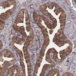 VPS26A Antibody in Immunohistochemistry (Paraffin) (IHC (P))