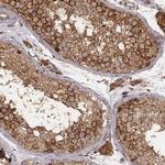 VPS26A Antibody in Immunohistochemistry (Paraffin) (IHC (P))