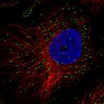 PMP70 Antibody in Immunocytochemistry (ICC/IF)