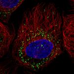 PMP70 Antibody in Immunocytochemistry (ICC/IF)