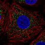 PMP70 Antibody in Immunocytochemistry (ICC/IF)