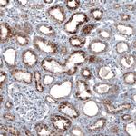 PMP70 Antibody in Immunohistochemistry (Paraffin) (IHC (P))