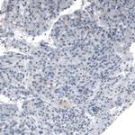 PMP70 Antibody in Immunohistochemistry (Paraffin) (IHC (P))