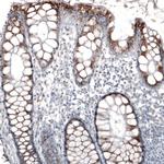 PMP70 Antibody in Immunohistochemistry (Paraffin) (IHC (P))