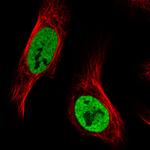 hnRNP C Antibody in Immunocytochemistry (ICC/IF)