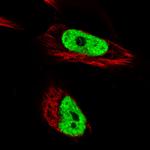 hnRNP C Antibody in Immunocytochemistry (ICC/IF)