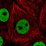 hnRNP C Antibody in Immunocytochemistry (ICC/IF)