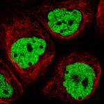 hnRNP C Antibody in Immunocytochemistry (ICC/IF)