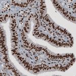 hnRNP C Antibody in Immunohistochemistry (Paraffin) (IHC (P))