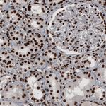 hnRNP C Antibody in Immunohistochemistry (Paraffin) (IHC (P))