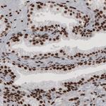 hnRNP C Antibody in Immunohistochemistry (Paraffin) (IHC (P))