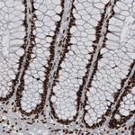 hnRNP C Antibody in Immunohistochemistry (Paraffin) (IHC (P))